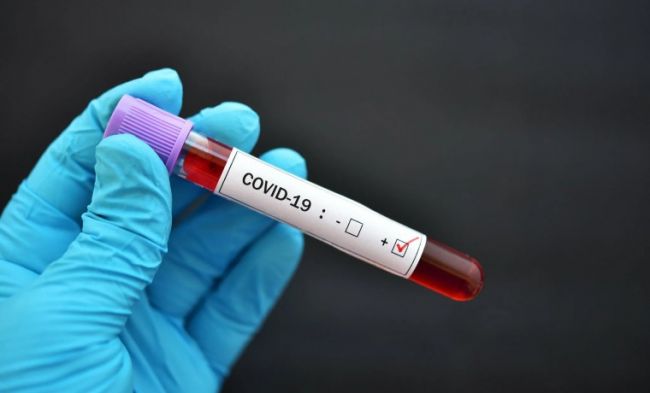German Scientist Says Laboratory Origin of Coronavirus Proven